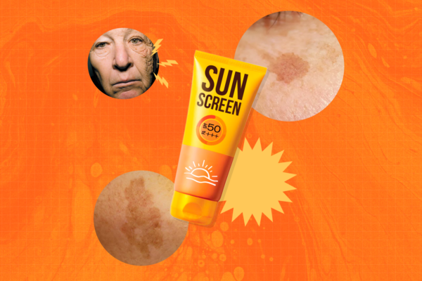 Kesan Buruk Pada Wajah Apabila Tak Pakai Sunscreen