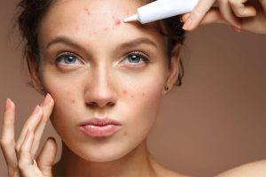 Medical-Acne-Treatment-Ensoul-Clinic-1